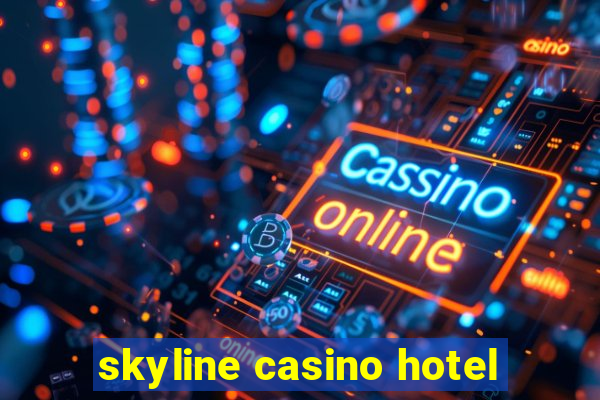 skyline casino hotel